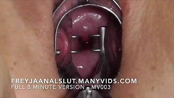 Amateur FreyjaAnalslut : Cervical Spreading - Opening Freyja's cunt showing you her tight cervix, and then opening Freyja's cervix with a speculum - Full version on ManyVids - xvideos.com